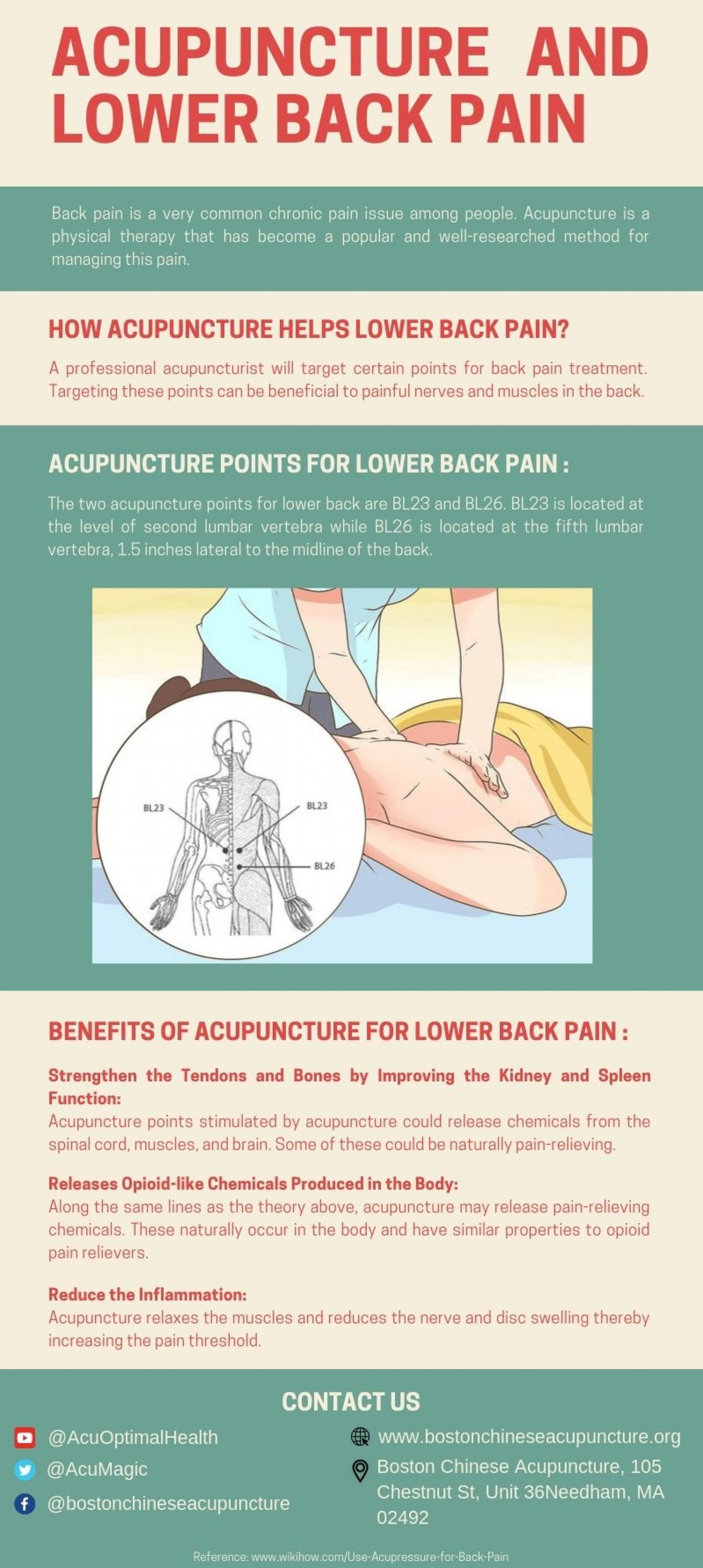 Acupuncture Points for Back Pain