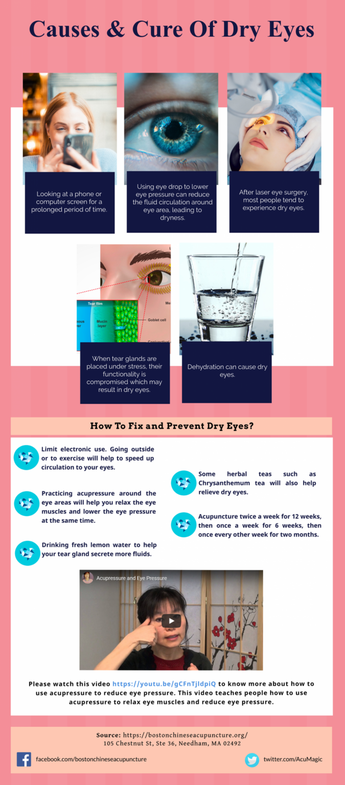 Acupressure Points for Dry Eye Boston Chinese Acupuncture